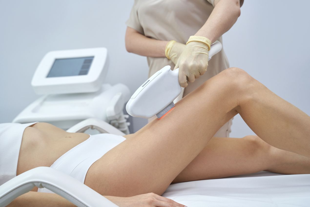 Frau erhaelt laser haarentfernung nuernberg mit professionellem IPL-Geraet am Oberschenkel
